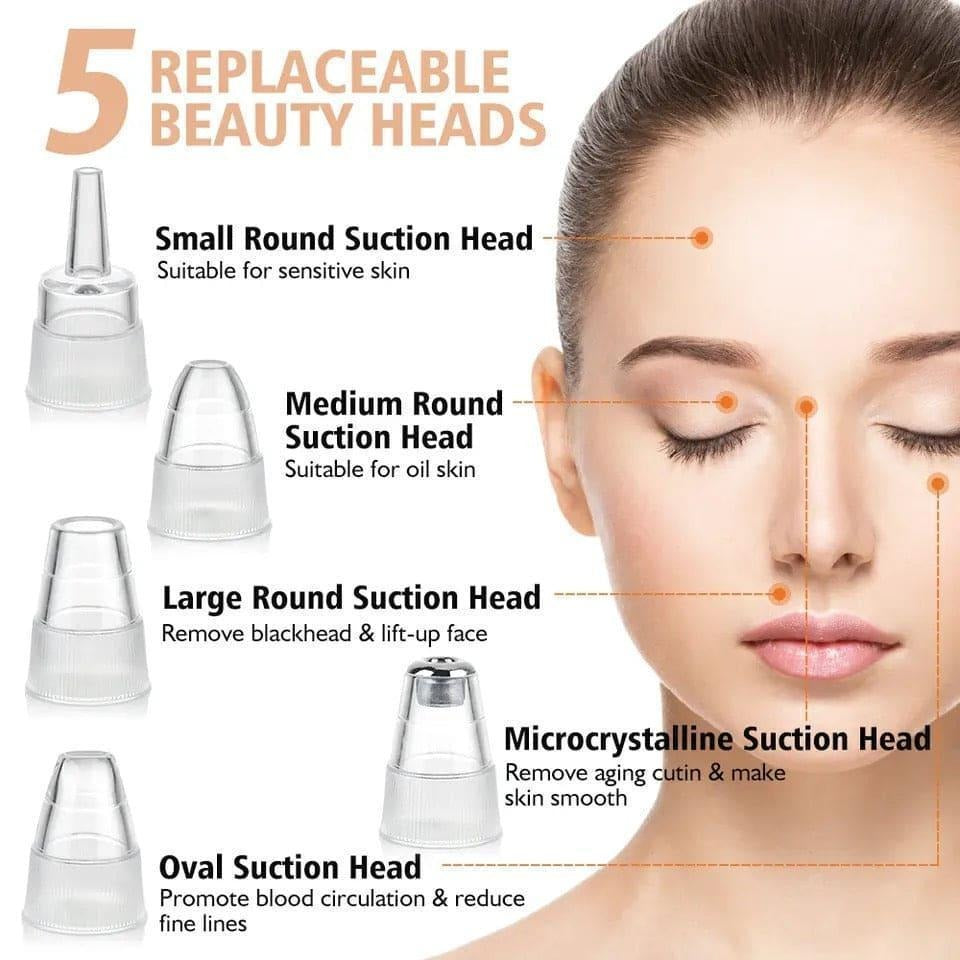 Electric Blackhead Remover Vacuum – Pore Cleaner & Acne Removal Device