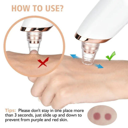 Electric Blackhead Remover Vacuum – Pore Cleaner & Acne Removal Device