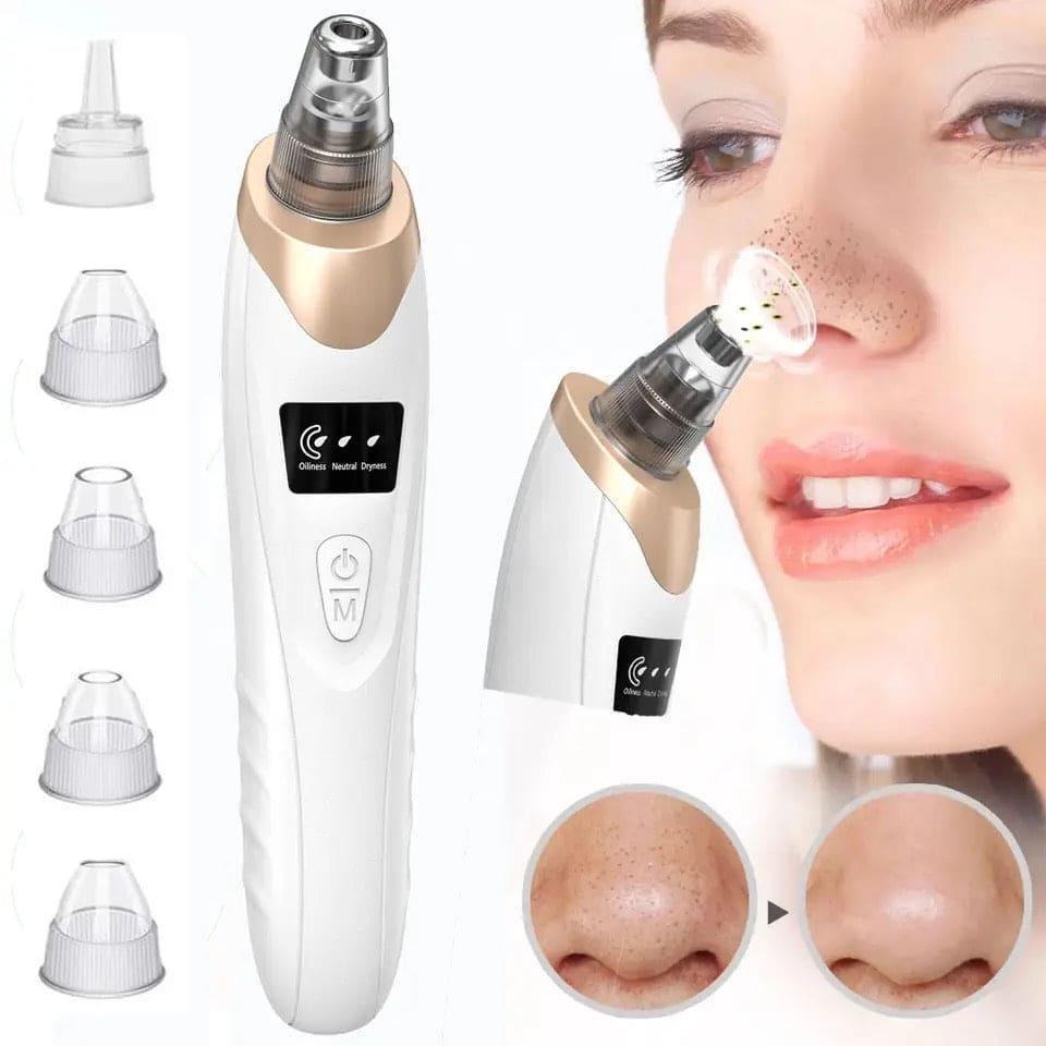 Electric Blackhead Remover Vacuum – Pore Cleaner & Acne Removal Device